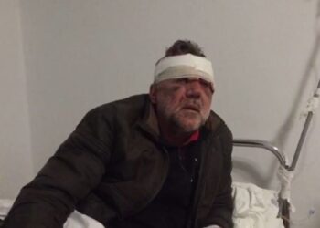“Profesor eja të qeras me një kafe”, dhunohet barbarisht mësuesi në Tepelenë, Laçi: Më morën në makinë dhe goditën papritur