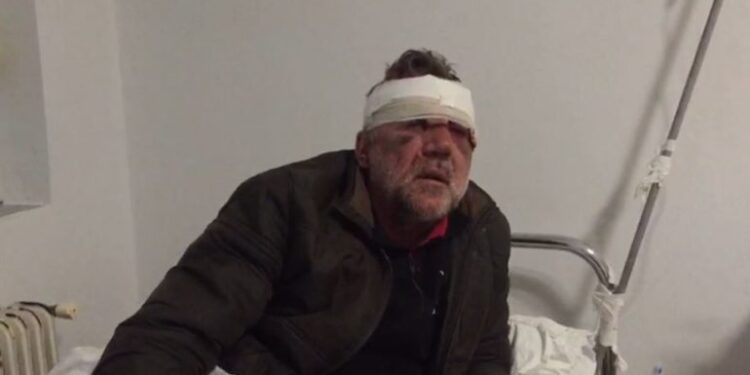 “Profesor eja të qeras me një kafe”, dhunohet barbarisht mësuesi në Tepelenë, Laçi: Më morën në makinë dhe goditën papritur