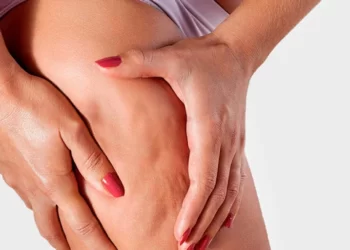 Keni celulit? Zbuloni faktorin që të gjithë e konsumoni