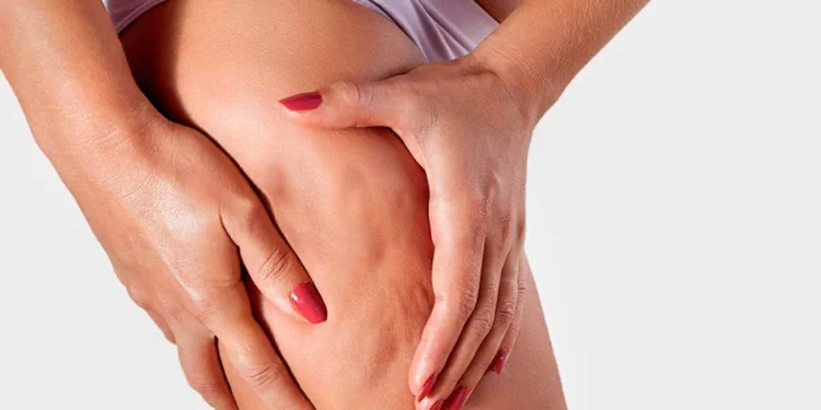 Keni celulit? Zbuloni faktorin që të gjithë e konsumoni