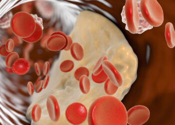 Këto janë shenjat si të dalloni nivelin e sheqerit në gjak kur është i ulët ose i lartë