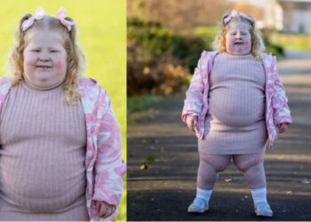 Sindromi i rallë i urisë, vajza 5- vjeçare në Britani peshon 45 kg, trupi i kërkon vazhdimisht ushqim