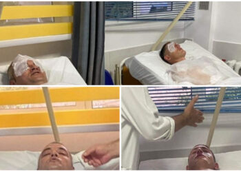 Spiunët rus që dëmtuan punonjësit në Uzinën e Gramshit/ Akt-espertiza: Ushtarët kanë pësuar lëndime në dorë, diegie lëkure dhe humbje aftësisë fizike 9 ditore