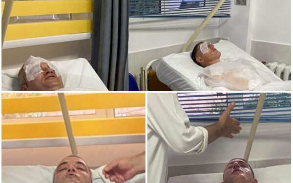 Spiunët rus që dëmtuan punonjësit në Uzinën e Gramshit/ Akt-espertiza: Ushtarët kanë pësuar lëndime në dorë, diegie lëkure dhe humbje aftësisë fizike 9 ditore