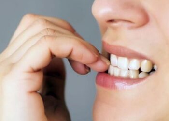 Ngrënia e thonjve, këto janë disa mënyra efikase si të hiqni vesin