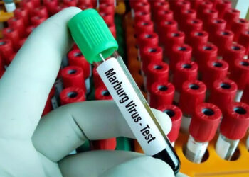 Çfarë është virusi Marburg që po kërcënon Afrikën Perëndimore?