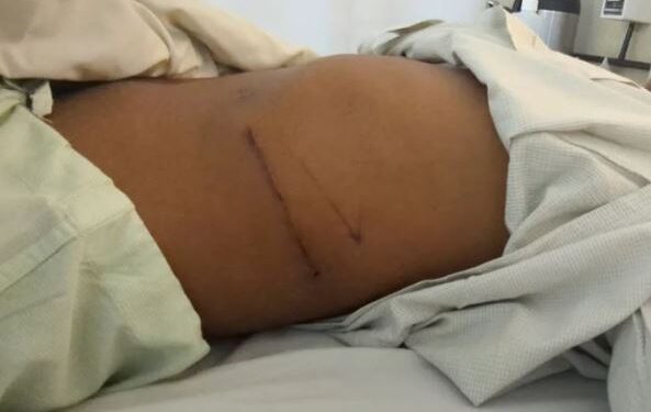 Birmani, të varfrit shesin veshkat e tyre online