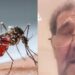 “Rashë si në koma”, pacienti zero me virusin e Nilit: Kisha dhimbje koke e temperaturë 40