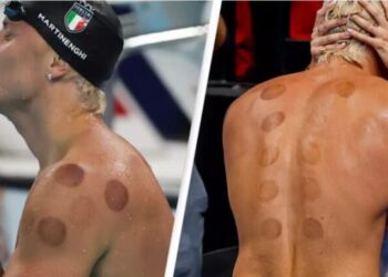 Ja përse sportistët olimpikë kanë rrathë të kuq të errët në shpinën e tyre