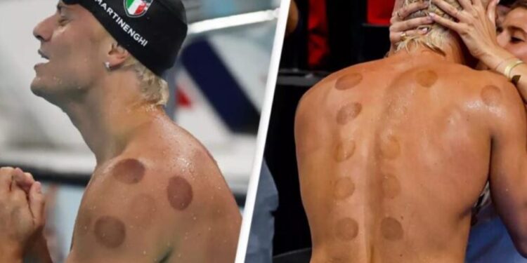 Ja përse sportistët olimpikë kanë rrathë të kuq të errët në shpinën e tyre